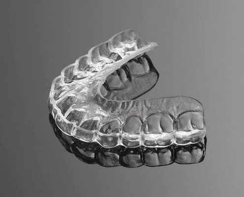 3m clear aligners